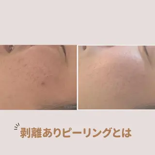 肌質改善 KALANCHOEのエステ・リラクイメージ