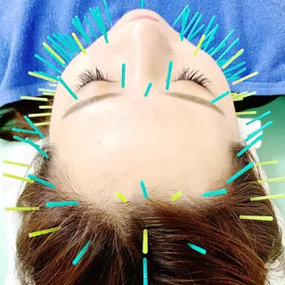 小顔美容鍼専門サロン 渋谷YZのエステ・リラクイメージ