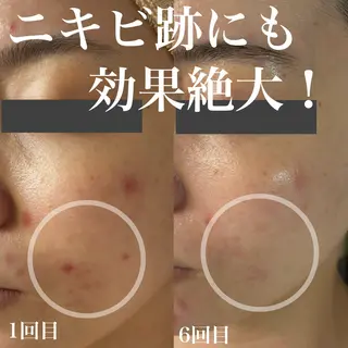 WHITE AQUA 北千住店のエステ・リラクイメージ