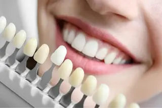 セルフホワイトニング Ines渡辺リエのその他イメージ