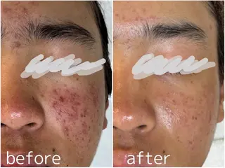 田中For..天王寺 肌質改善/よもぎ蒸しのエステ・リラクイメージ