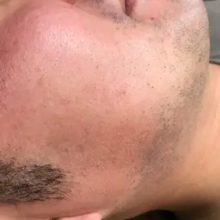 Lilyboo 星のエステ・リラクイメージ