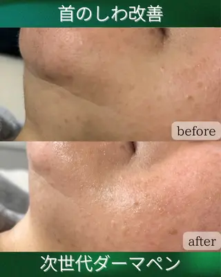 Rairy所属・Rairy Salon富士見町のエステ・リラクイメージ