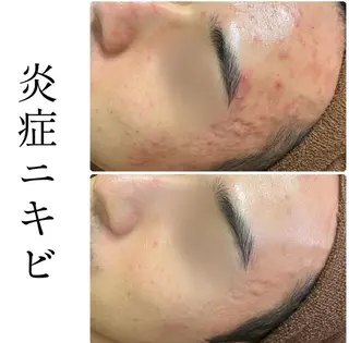 Bioplus +  ビオプラス川崎所属・ハーブピーリング専門 BIOPLUS＋川崎のエステ・リラクイメージ