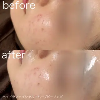 lulularico Yuのエステ・リラクイメージ