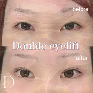 マツエク・マツパ 🩵ANELA東口 齋藤琴音💚のマツエク・マツパデザイン