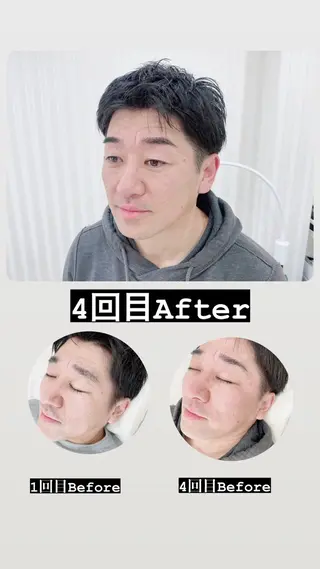 アイブロウ Salon de Galcon 2階(サロンド・ギャルソン)所属・KU TA  \(◡̈)/のエステ・リラクイメージ