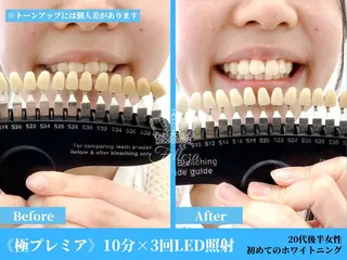 有人型セルフサロン 脱毛/痩身/美顔のその他イメージ