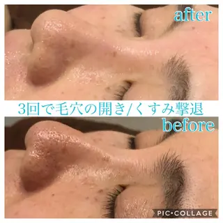 ミディアム カラー パーマ ヘアアレンジ キッズ ネイル マツエク・マツパ Ensor Clair所属・EnsorClair 代表 野口真央のエステ・リラクイメージ