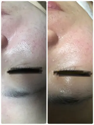 トータルエステサロン Tiaraのエステ・リラクイメージ