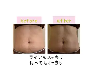 メンズ 癒し腸もみサロン シャユーム　ゆきなのエステ・リラクイメージ