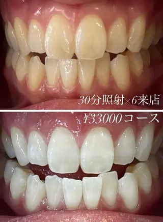 PLATINUM Beauty 横浜店所属・ホワイトニングルーム 横浜店のその他イメージ