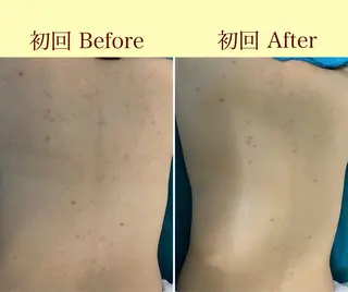 メンズ歓迎🙆‍♀️ エステ/ネイルISTのエステ・リラクイメージ