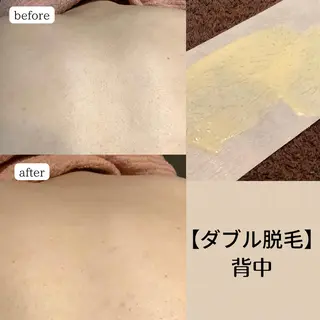 脱毛&エステサロン JIGGLY☆松田のエステ・リラクイメージ