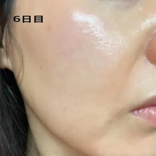 ナピュレ サロンのマツエク・マツパデザイン