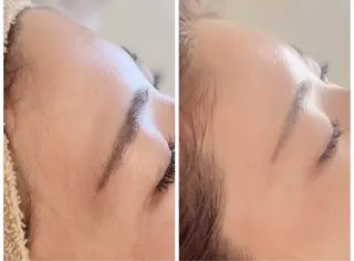 小顔/たるみ/黒ずみ除去専門サロン/SONA 大和西大寺店所属・【小顔専門看護師 サロンSONA】のエステ・リラクイメージ