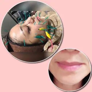 セントラル鍼灸院 Re:laxyのエステ・リラクイメージ