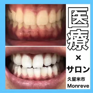 Monreve所属・美人スイッチdiet スーパージェクションのその他イメージ