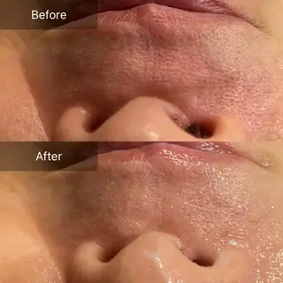 Mandarin Orange所属・毛穴から始める肌メン テマンダリンオレンジのエステ・リラクイメージ