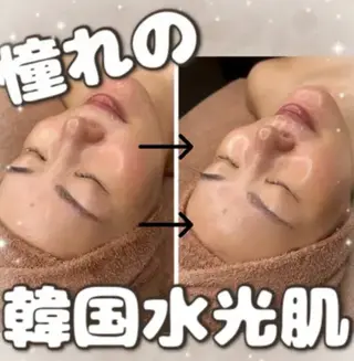毛穴・ニキビケア・ハーブピーリング 肌管理専門店 WHITE AQUA 神戸三宮店所属・🌷あいり 🌷のエステ・リラクイメージ