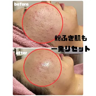 肌質改善専門店/絹々(きぬ)所属・心満たされる ハーブピーリング絹々のエステ・リラクイメージ