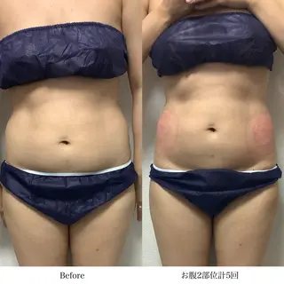 冷却専門店 SLARIのエステ・リラクイメージ