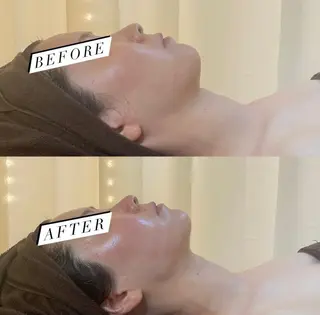 BELCIA福岡店　récolte de BELCIA（レコルトデベルシア）所属・BELCIA福岡店 レコルトデベルシアのエステ・リラクイメージ