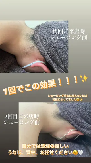 都度払い制脱毛サロンBe Charm所属・Be Charm 山﨑のエステ・リラクイメージ