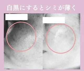 🦋毛穴洗浄/肌改善 laule'a🦋のエステ・リラクイメージ