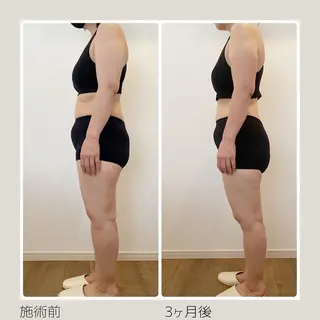 痩身＆ヘッド 長倉絵美のエステ・リラクイメージ