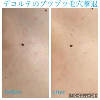 ミディアム カラー パーマ ヘアアレンジ キッズ ネイル マツエク・マツパ Ensor Clair所属・EnsorClair 代表 野口真央のエステ・リラクイメージ