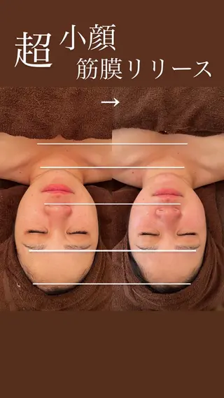 毛穴ケア/毛穴診断/ 毛穴洗浄〔心斎橋〕のエステ・リラクイメージ