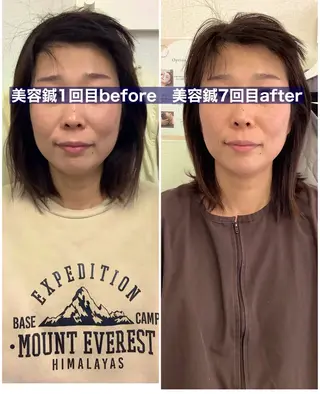 メディカルサロンドオフ所属・ハリサロンドオフ 美容鍼灸×小顔整体のエステ・リラクイメージ