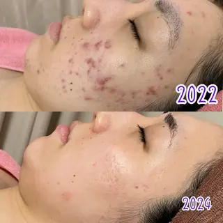 透明感の肌Lino malieのエステ・リラクイメージ