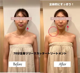 痩身×フェイシャル ブライダル|Linoのエステ・リラクイメージ