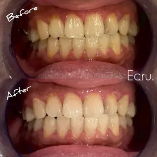 メンズ キッズ ホワイトニングサロン Ecru所属・ホワイトニングサロン Ecru エクリュのその他イメージ