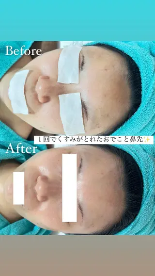都度払い制脱毛サロンBe Charm所属・Be Charm 山﨑のエステ・リラクイメージ