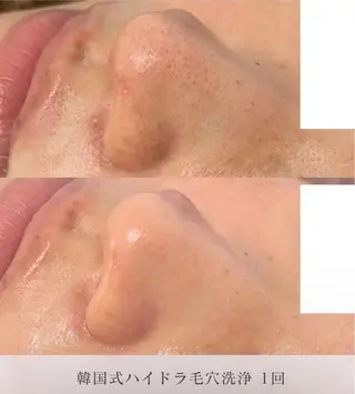 美肌・小顔専門🪄 看護師施術/松﨑のその他イメージ