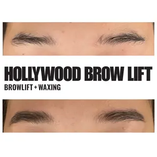 アイブロウ 美容鍼灸整体サロンBeauJu所属・小顔矯/美容鍼/鍼灸 BeauJuのその他イメージ