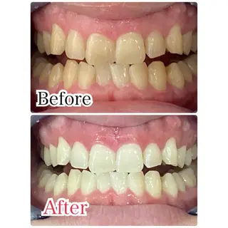 ロング カラー パーマ ヘアアレンジ メンズ キッズ ネイル マツエク・マツパ アイブロウ プラチナムビューティー柏所属・【歯科提携】柏ホワイ トニングスタイルのその他イメージ