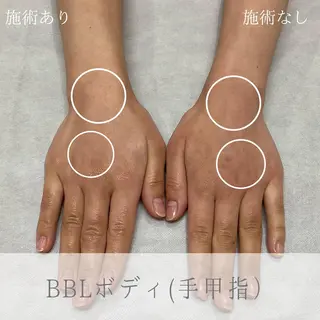 ciena KAYOのエステ・リラクイメージ