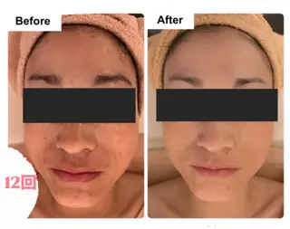 esthesalon O'-en-所属・esthesalon O'-en-のエステ・リラクイメージ