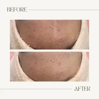 CEsalonEgg 齋藤のエステ・リラクイメージ