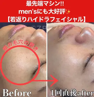 部分痩せ♥️小顔専門 MIKUのエステ・リラクイメージ