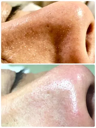 private salon Dea_maris シュガーリング&パーソナルボディケア所属・シミ改善・韓国肌管理 ボディメイク痩身のその他イメージ