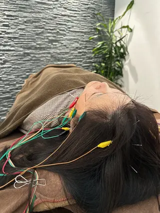 美容鍼灸整体サロンBeauJu所属・小顔矯/美容鍼/鍼灸 BeauJuのその他イメージ