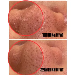 肌質改善専門店/絹々(きぬ)所属・心満たされる ハーブピーリング絹々のエステ・リラクイメージ