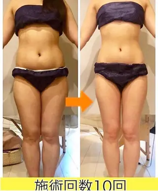 ショート カラー パーマ ヘアアレンジ メンズ キッズ ネイル マツエク・マツパ 痩身&ボディ 結果出し🌟丹野のエステ・リラクイメージ