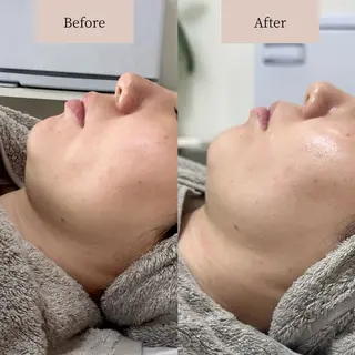 lafleur Yurinaのエステ・リラクイメージ