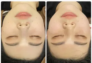 FLEUR大阪・整体 ・ハイフ・痩身・小顔のエステ・リラクイメージ